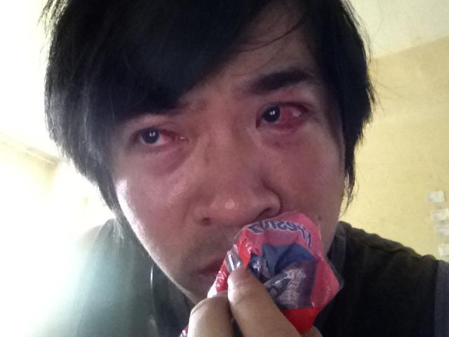 Steven Lim Intentionally Shot and Injured in Both Eyes by Confetti Rocket - Alvinology