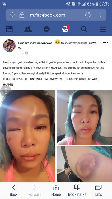 Woman gets beaten up, accuses her husband in a public Facebook post Woman gets beaten up, accuses her husband in a public Facebook post - Alvinology