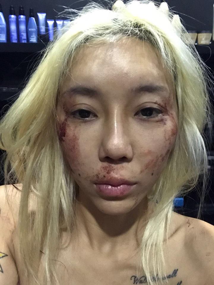 Malaysian DJ Leng Yein, allegedly abused for two years by her ex-boyfriend, speaks up against domestic violence - Alvinology