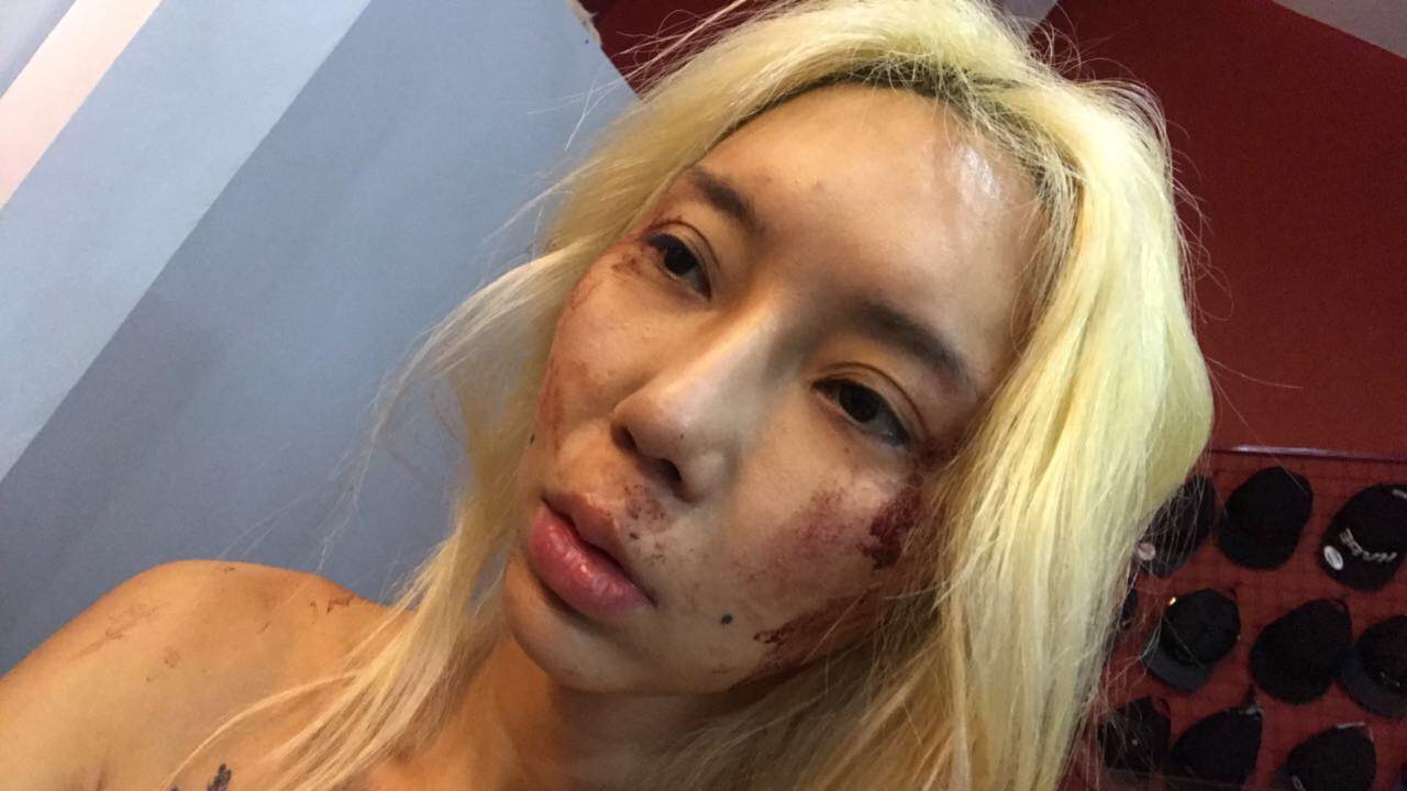 Malaysian DJ Leng Yein, allegedly abused for two years by her ex-boyfriend, speaks up against domestic violence - Alvinology