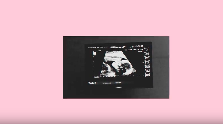 Naomi Neo pregnancy details on her then-boyfriend's reaction, symptoms, and how she's dealing with it so far - Alvinology