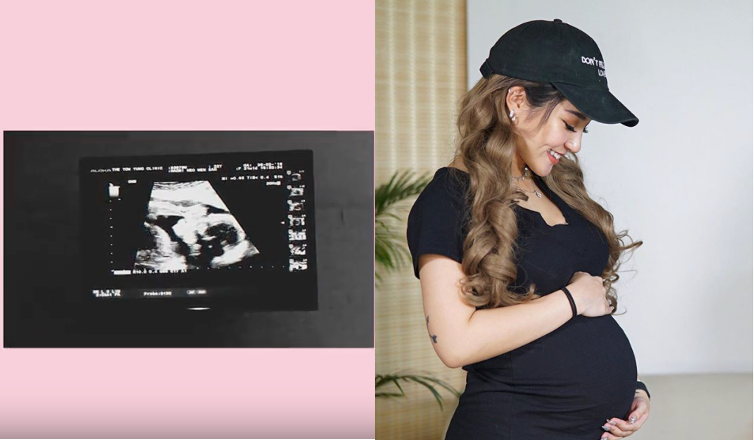 Naomi Neo pregnancy details on her then-boyfriend's reaction, symptoms, and how she's dealing with it so far - Alvinology
