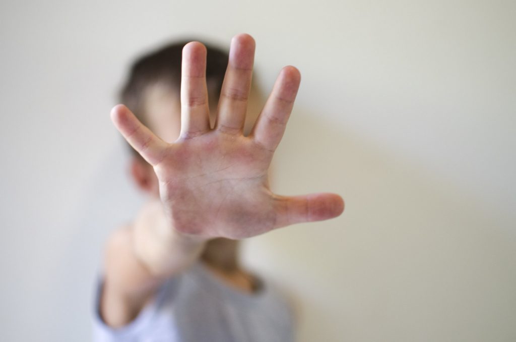 Mother said 5-year-old boy's "attitude" made her scald him - Alvinology