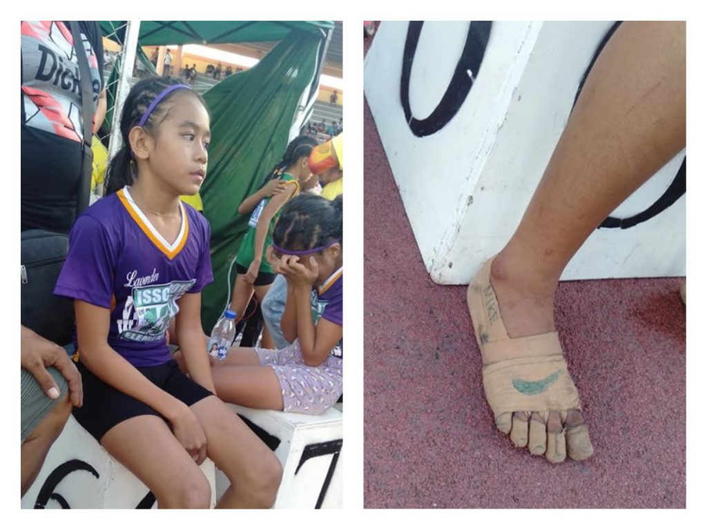 Who is Rhea Bullos? Did she win three races barefooted? - Alvinology