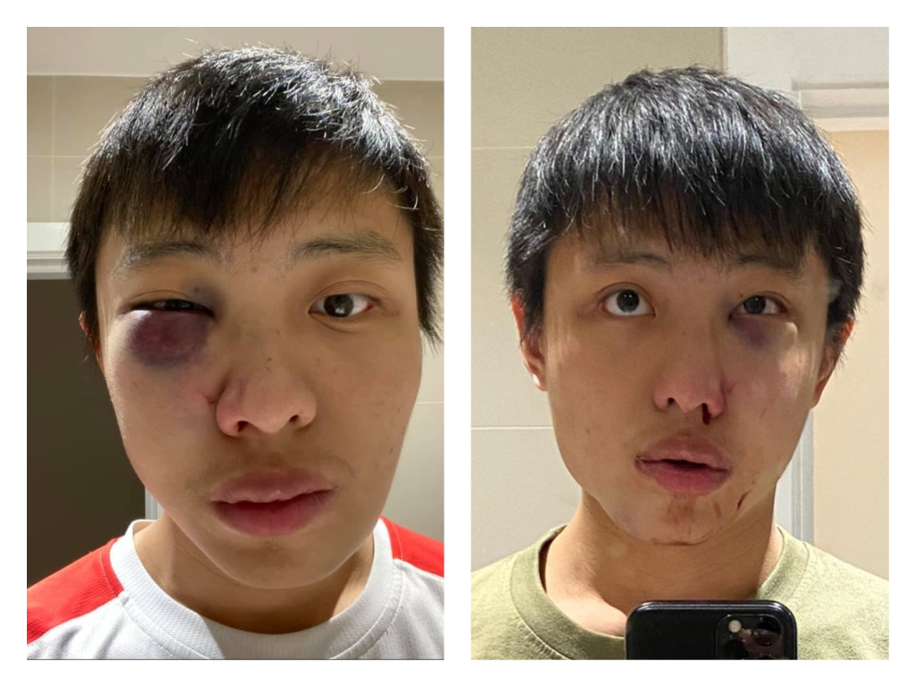Singaporean student pummeled in UK over Wuhan coronavirus - Alvinology