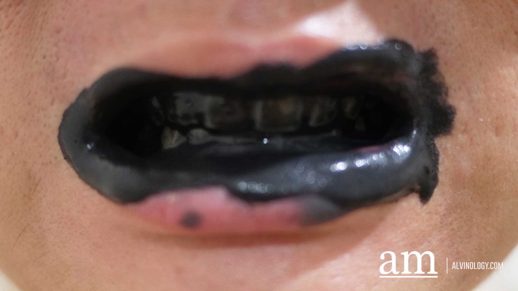 Pearly White Teeth with White Glo Singapore - Alvinology