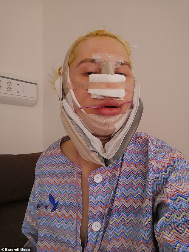 British man has more than SGD$200K worth of surgeries to mimic BTS Jimin; Releases K-pop song British man has more than SGD$200K worth of surgeries to mimic BTS Jimin; Releases K-pop song - Alvinology