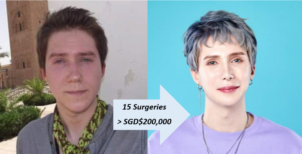 British man has more than SGD$200K worth of surgeries to mimic BTS Jimin; Releases K-pop song - Alvinology