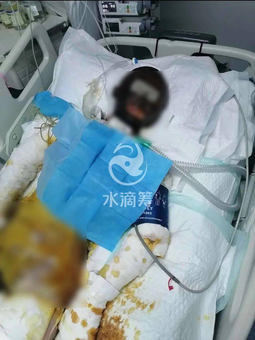 Jealous husband burns popular Tibetan video blogger alive - Alvinology