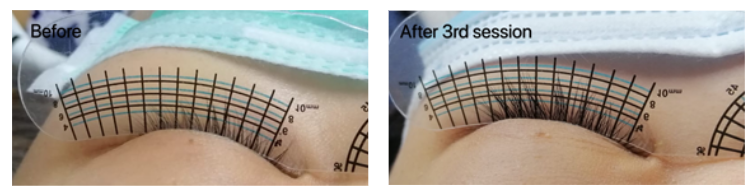 Look confident and let your eyelashes grow pretty with Browhaus’ newest Lash Resurrection treatment Look confident and let your eyelashes grow pretty with Browhaus’ newest Lash Resurrection treatment - Alvinology