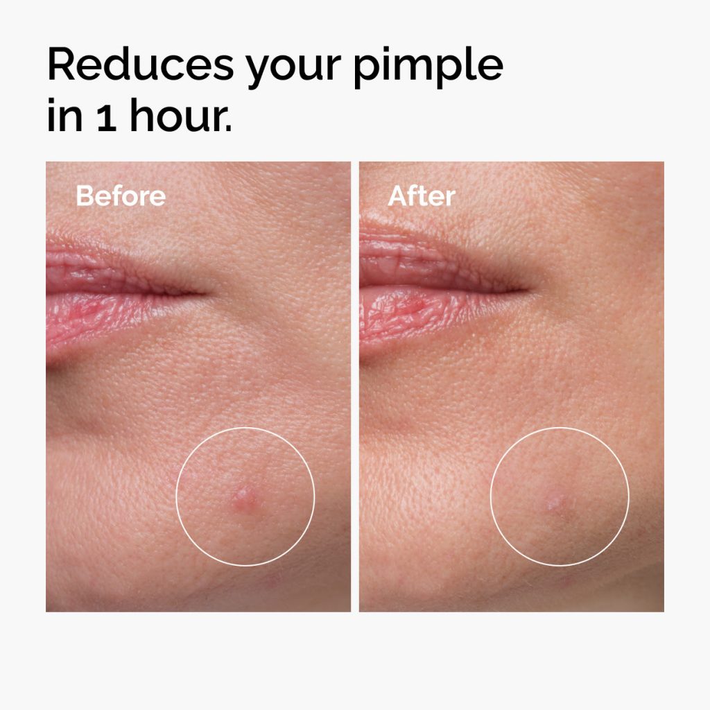 The Ordinary Launches Fast-Acting Sulfur 10% Powder-to-Cream Blemish Treatment in Singapore - Alvinology