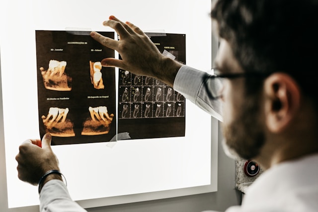 How Managing Adult Tooth Movement Protects Long Term Jaw Health - Alvinology